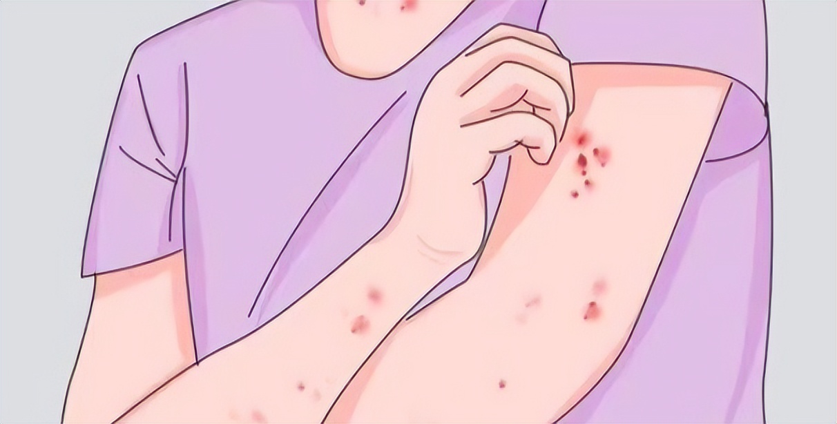 白鲜皮地肤子止痒_湿热风热皮肤病治疗_白鲜皮搭配禁忌