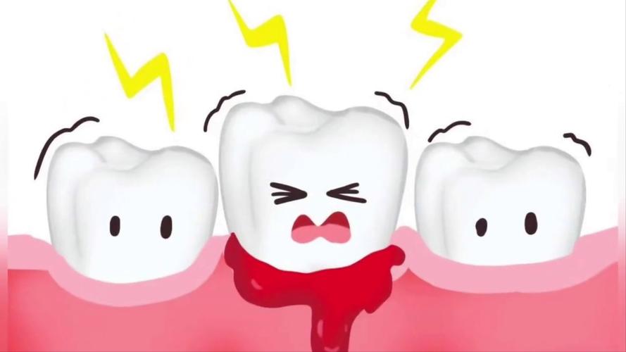 中医入门牙龈出血_牙龈出血 全身性疾病 早期信号