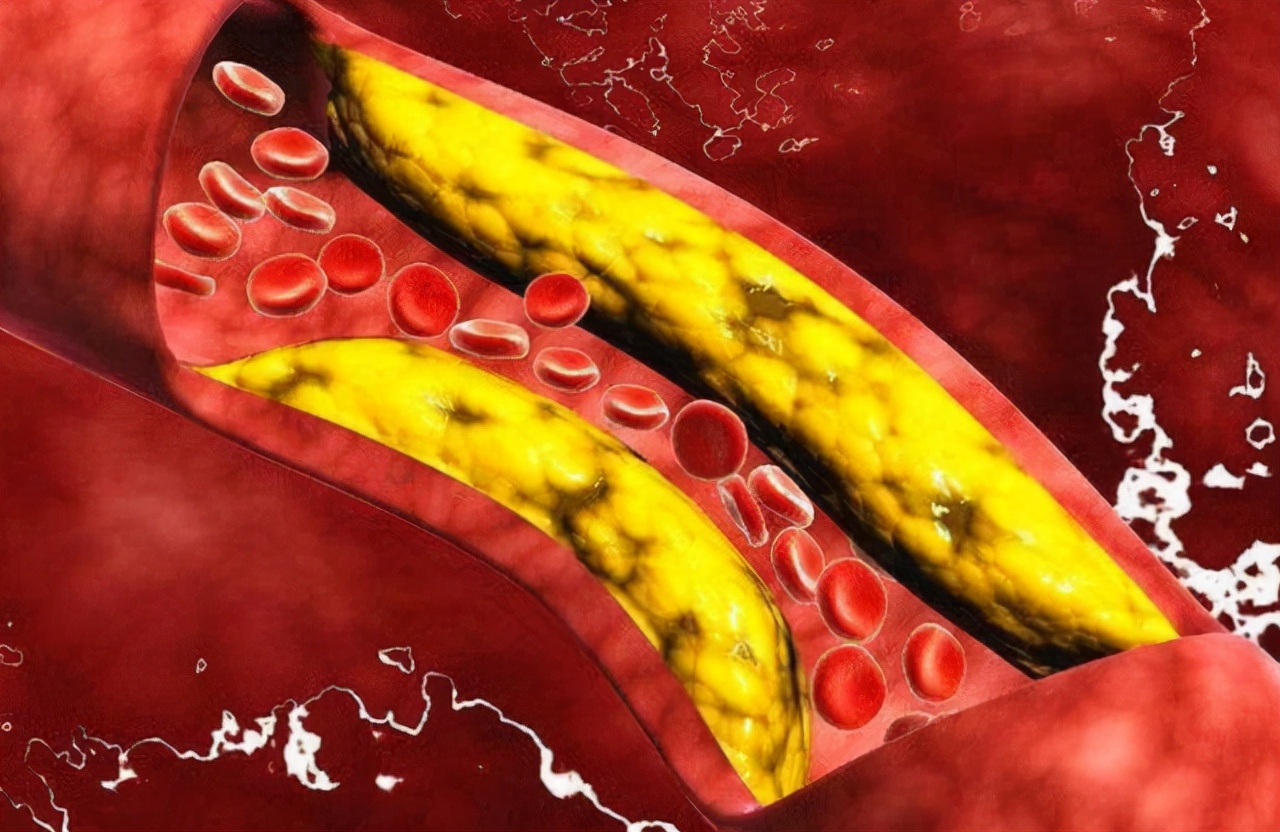 小米粥对血糖的影响_中医糖尿病小米养护_小米粥养胃功效