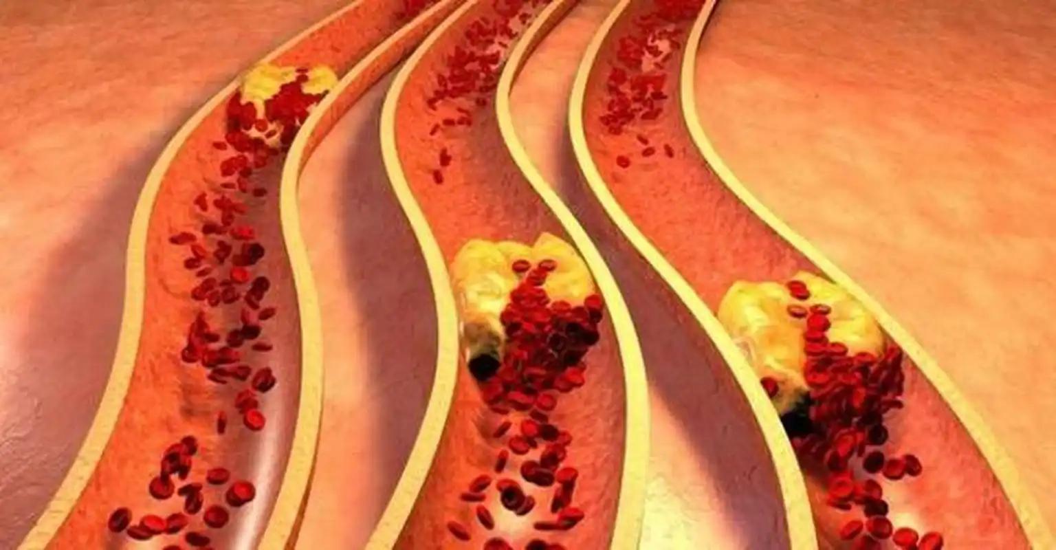 燕麦食疗_燕麦β-葡聚糖调脂研究_燕麦降脂作用