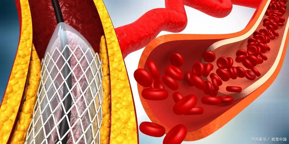 血瘀危害_调理血瘀体质最有效的_血瘀体质形成原因