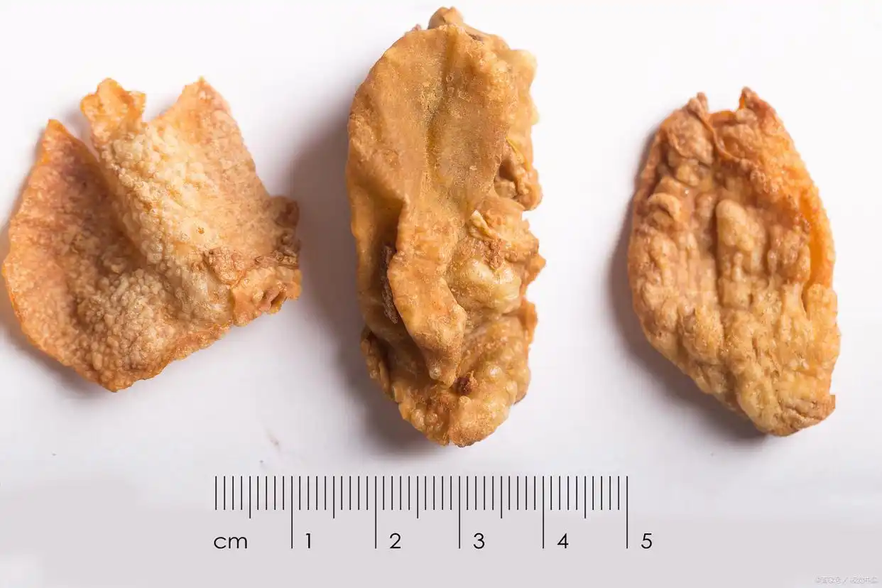 血瘀体质形成原因_血瘀危害_调理血瘀体质最有效的