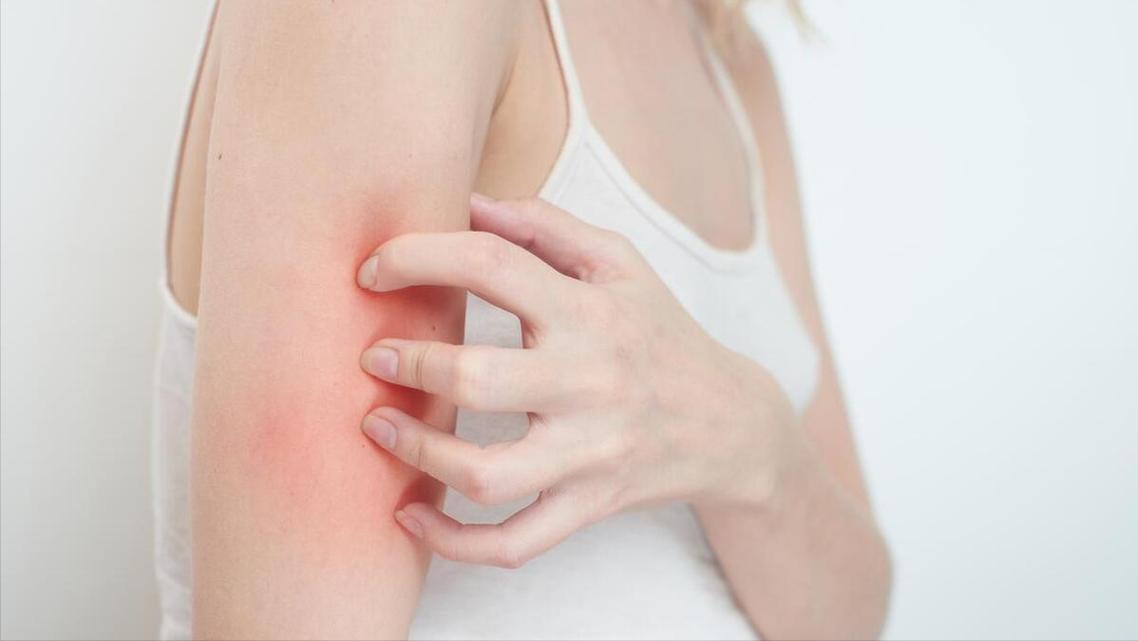 带状疱疹患者饮食禁忌_带状疱疹重症预防_带状疱疹后遗神经痛治疗