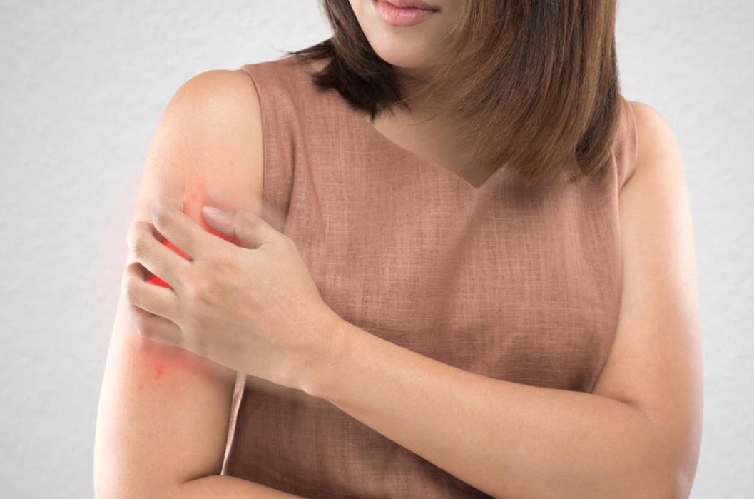 带状疱疹患者饮食禁忌_带状疱疹后遗神经痛治疗_带状疱疹重症预防