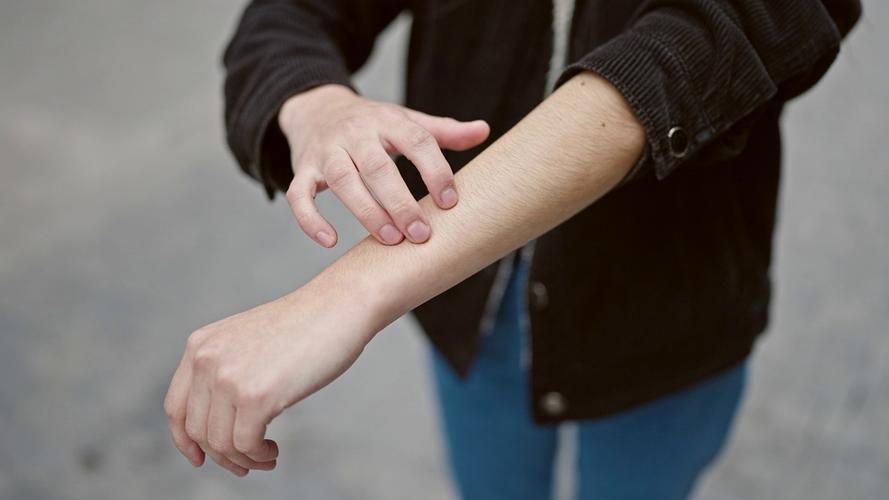 带状疱疹患者饮食禁忌_带状疱疹后遗神经痛治疗_带状疱疹重症预防