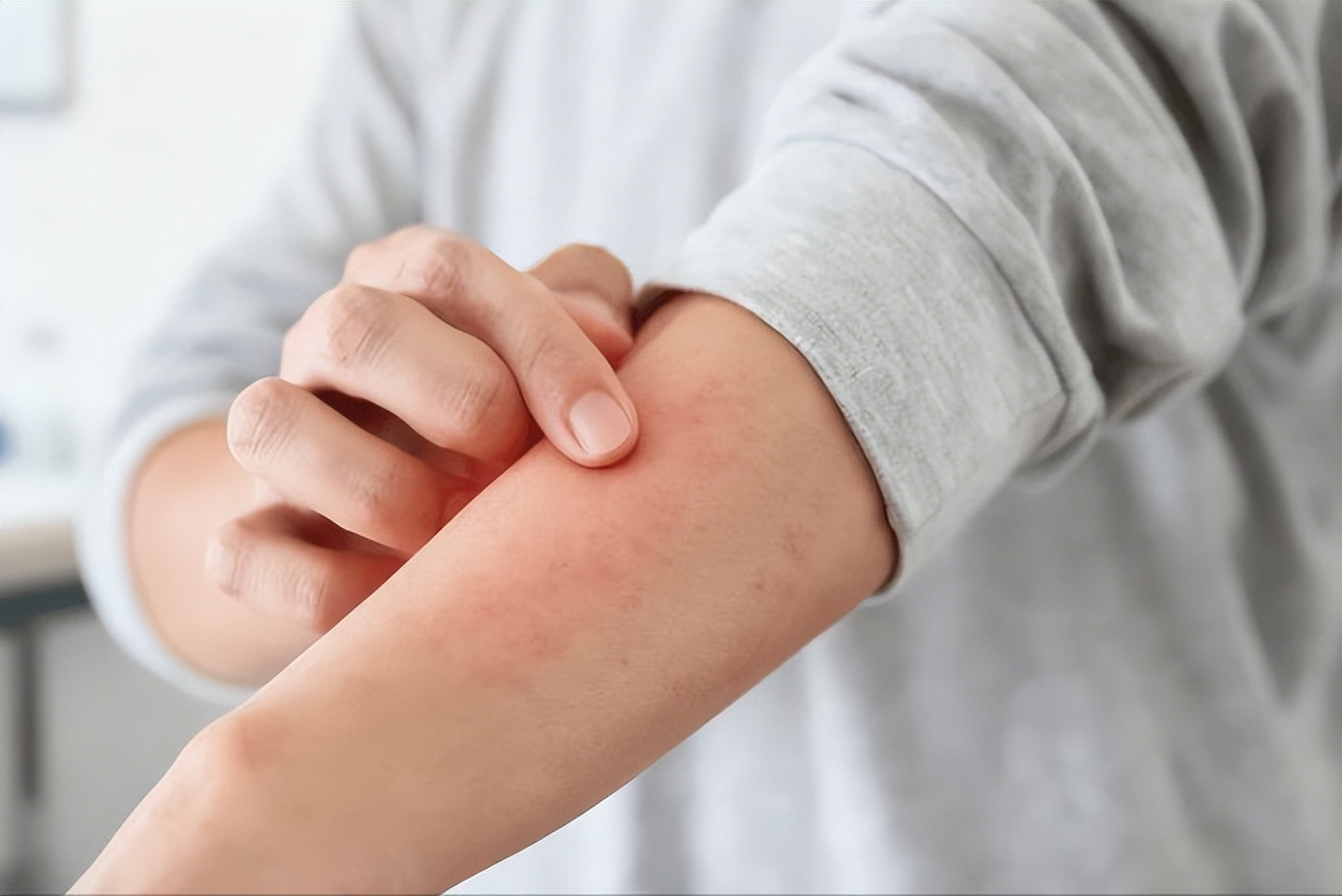 带状疱疹患者饮食禁忌_带状疱疹后神经痛预防_带状疱疹并发症