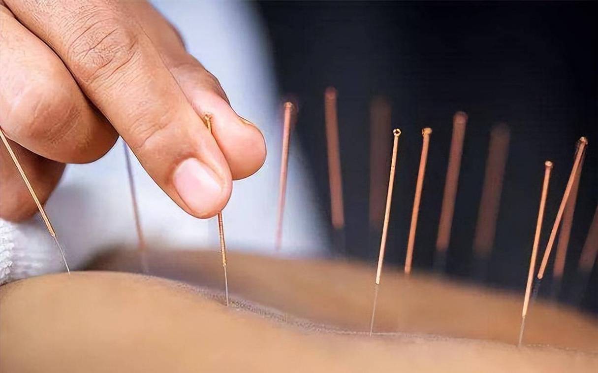 带状疱疹患者饮食禁忌_带状疱疹后遗神经痛治疗_带状疱疹重症预防