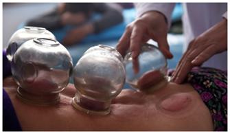 艾灸刮痧拔罐_中医养生保健疗法_中医腰部刮痧