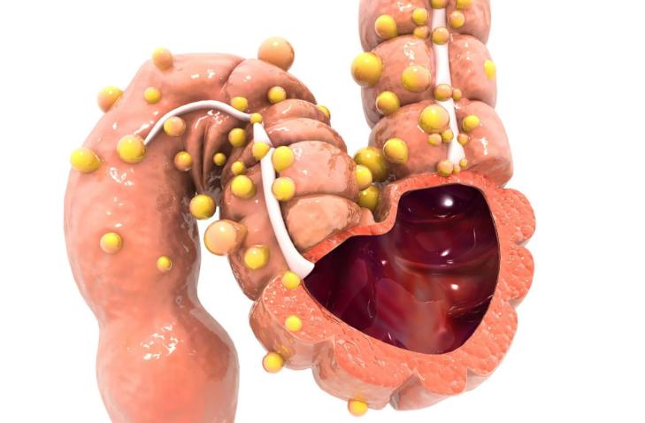 老中医推荐通便方法_便秘老中医治疗法_女性便秘的治疗偏方