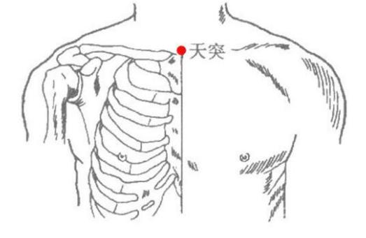 痰多中医治疗_天突穴祛痰_中医按摩化痰止咳