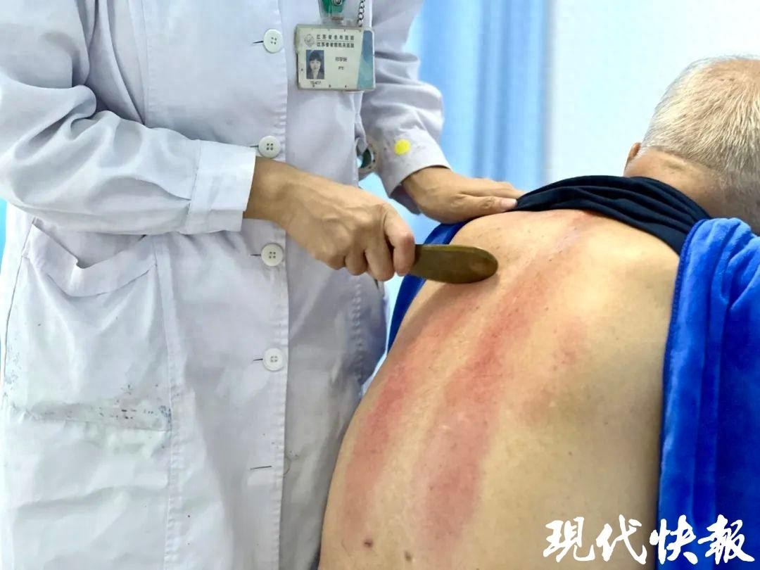 中医气虚体质刮痧_盲目刮痧拔罐艾灸危害_刮痧拔罐艾灸误区