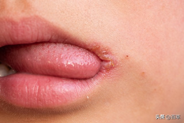 滋阴降火_阴虚虚火_长期虚火体质怎么调理