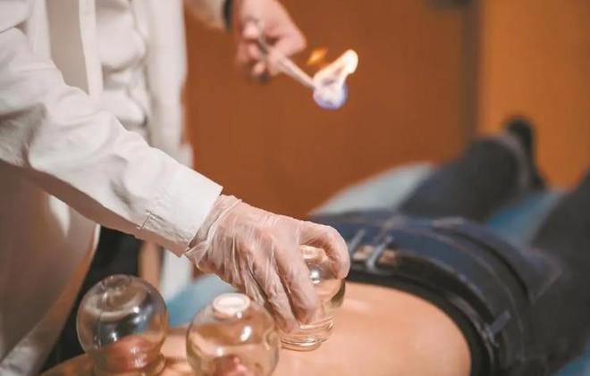 拔火罐瘀血印记_拔火罐排毒误区_中医拔罐