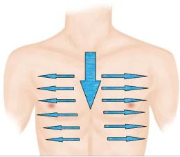 居家刮痧疗法_刮痧板使用方法_中医刮痧板