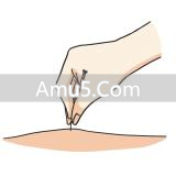 中医经络系统_经络气血运行_什么是经络穴位