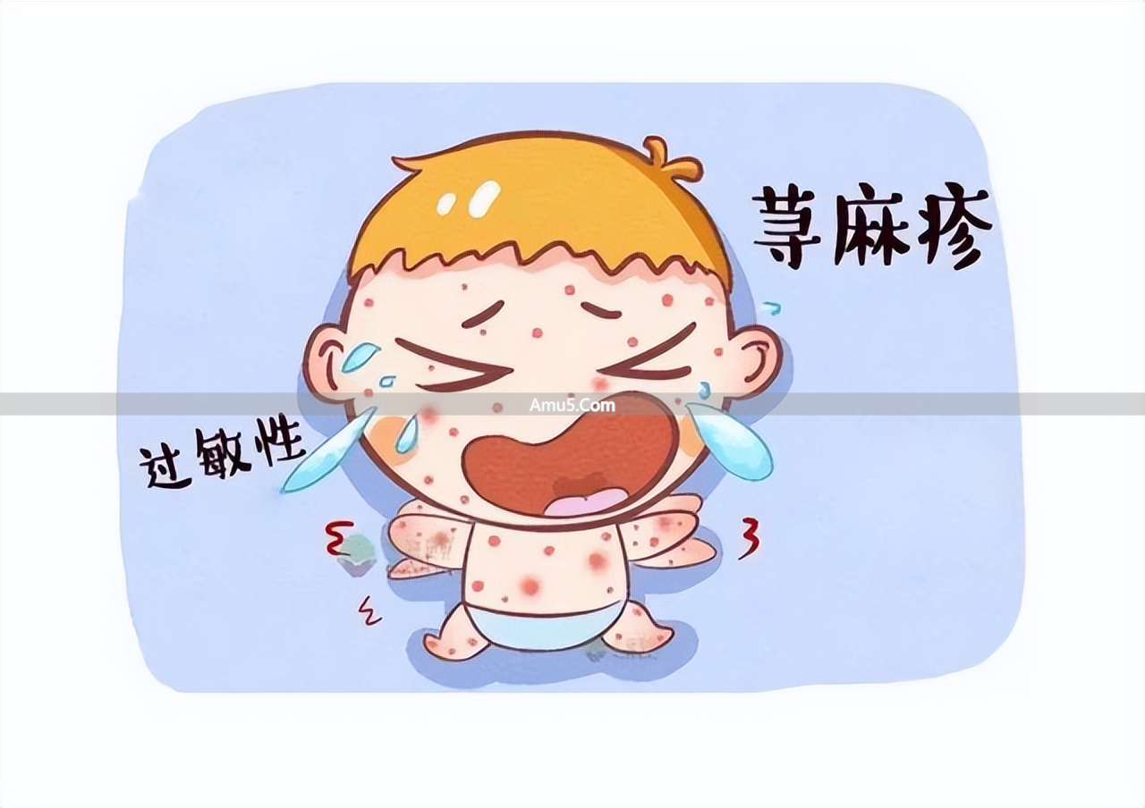 中医古法养生改善荨麻疹_荨麻疹中医辨证施治_慢性荨麻疹中医治疗