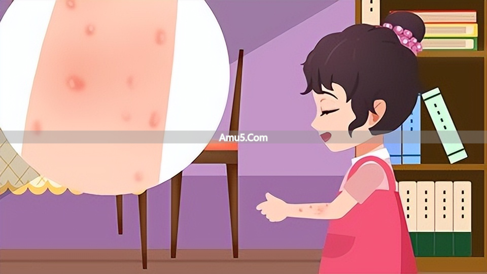 荨麻疹中医辨证施治_中医古法养生改善荨麻疹_慢性荨麻疹中医治疗