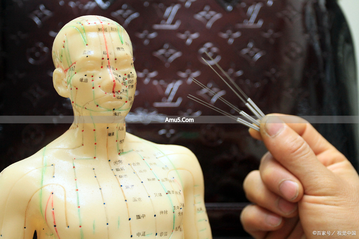 针刺保健法原理与实践方法_针刺穴位调理脏腑功能保健养生_中医穴位养生禁忌