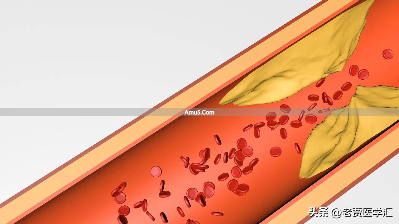 中医入门经络不通_气郁导致堵塞怎么办_中医堵塞经脉怎么办
