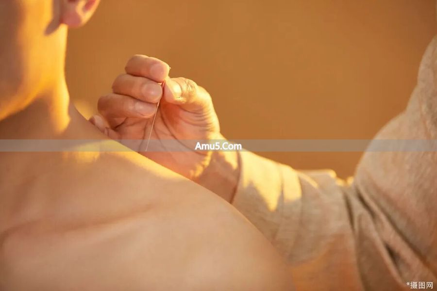 针灸调和气血疏通经络 _ 经络和针灸的关系 _ 针灸调整作用双向调节