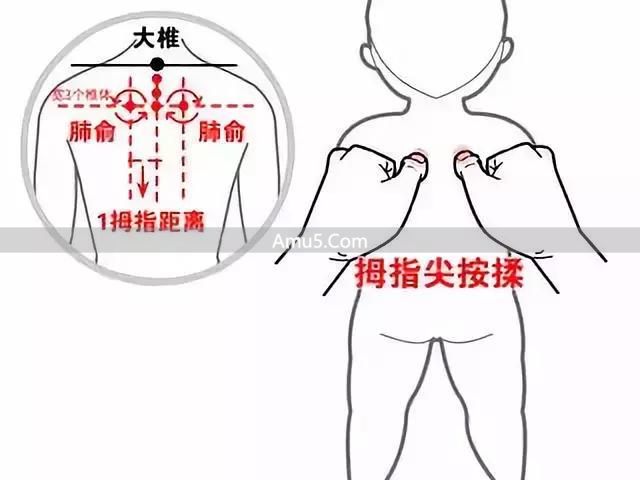 祛痰穴位按摩方法 _ 中医痰湿体质调理 _ 中医按摩化痰止咳